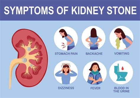 Kidney stone disease .